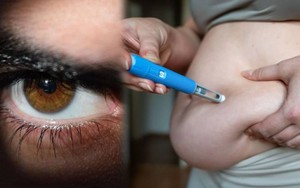 Kh&ocirc;ng phải BMI: Một chỉ số kh&aacute;c c&oacute; thể 