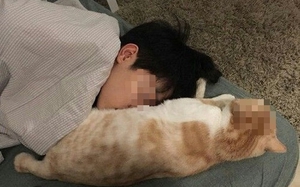 Bị m&egrave;o nh&agrave; cắn, người phụ nữ nguy kịch - Ảnh 2.