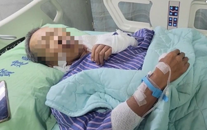Người đàn ông 53 tuổi mắc cùng lúc 5 loại ung thư vì 2 thú vui của nhiều người Việt