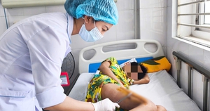 B&eacute; trai 9 tuổi su&yacute;t tắc đường thở chỉ v&igrave; mẹ tự nhổ răng cho tại nh&agrave; - Ảnh 2.