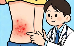Mỡ m&aacute;u từ 7,1 xuống c&ograve;n 1,4 sau v&agrave;i th&aacute;ng: Người đ&agrave;n &ocirc;ng 54 tuổi tiết lộ 3 th&oacute;i quen bỏ c&agrave;ng sớm, mạch m&aacute;u c&agrave;ng 