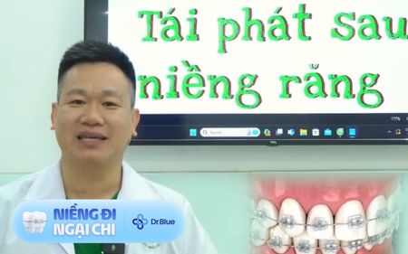 Niềng răng 3 năm, giờ phải niềng lại: Bác sĩ chỉ ra 6 nguyên nhân không ai ngờ tới