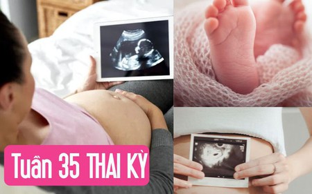 Tuần thai thứ 35: Phổi bé đã hoàn thiện, đủ khả năng hô hấp để chào đời