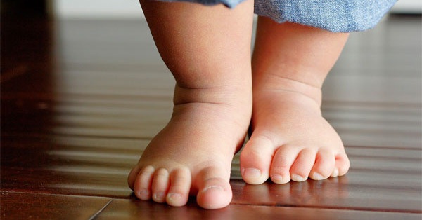 Bé bị chân vòng kiềng, khi nào cần điều trị?