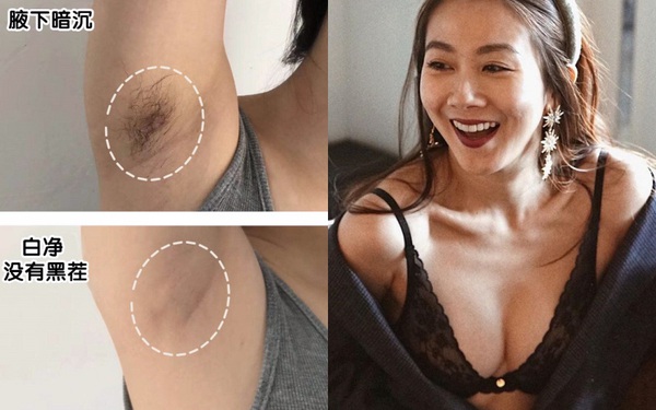 10 loại kem tẩy lông vừa dịu nhẹ lại hiệu quả cao trong việc dọn sạch đám