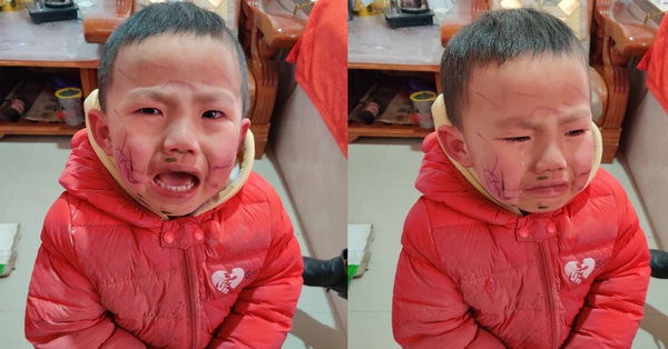 Cậu bé vẽ nguệch ngoạc khắp mặt rồi khóc thét ăn vạ sau khi ngắm