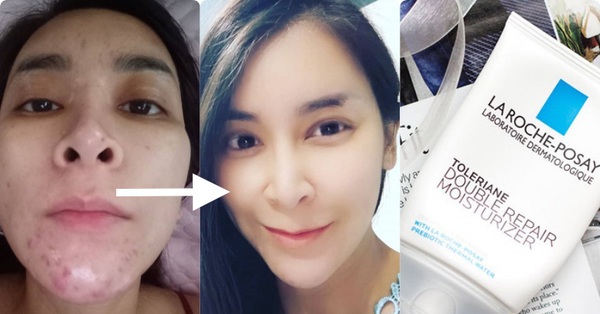 Chẳng phải Vit C hay Retinol, đây mới là thành phần mà mọi bác sĩ da liễu đều khuyên chị em nên dùng để có làn da sáng mịn như gái đôi mươi