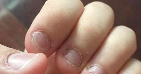Mẹ tự hào vì con trai 5 tuổi luôn giữ móng tay gọn sạch, để rồi