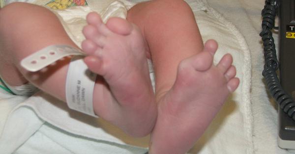 Thấy con gái mới sinh có ngón chân cái kỳ lạ, bố mẹ đi xét nghiệm rồi kinh hoàng nghe bác sĩ chẩn đoán con sẽ bị "hóa đá" - Vimarsana News