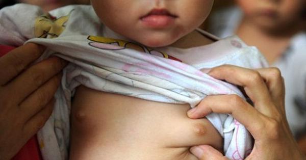 Thấy con gái mới 2 tuổi đã phát triển ngực, bà mẹ hốt hoảng cho con đi khám - Vimarsana News