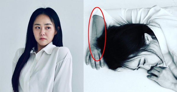 “National little sister” Moon Geun Young revealed her long scar for the first time after undergoing 4 surgeries