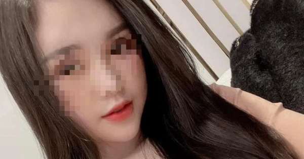 The 22-year-old girl who underwent plastic surgery died after 2 months of living a vegetative life