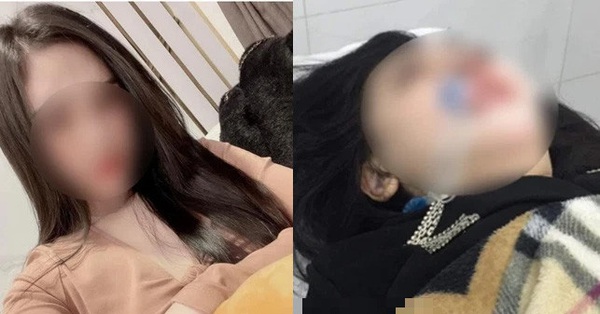 22-year-old single mother died from rhinoplasty in Hanoi: Police got involved