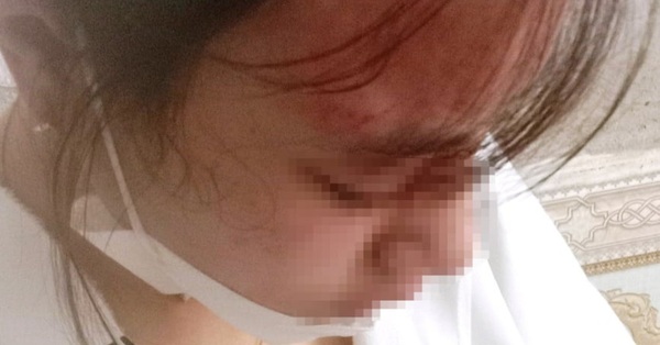 The 10th grade girl was assaulted by a grocery store owner to “concussion”