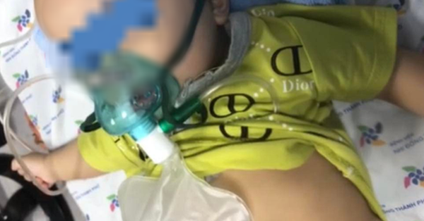 Saving the life of a 5-month-old baby with COVID-19 causing acute laryngitis, severe respiratory failure
