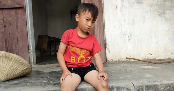 7-year-old boy was rejected by his father because he was born without an anus, mentally retarded