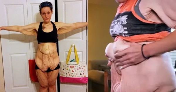 Successfully losing weight, a woman still hates her body