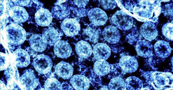 Are new variants of the SARS-CoV-2 virus of concern?