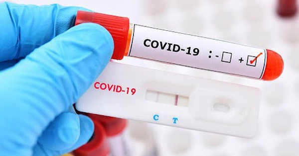 Hanoi covid detected 373 people with COVID-19