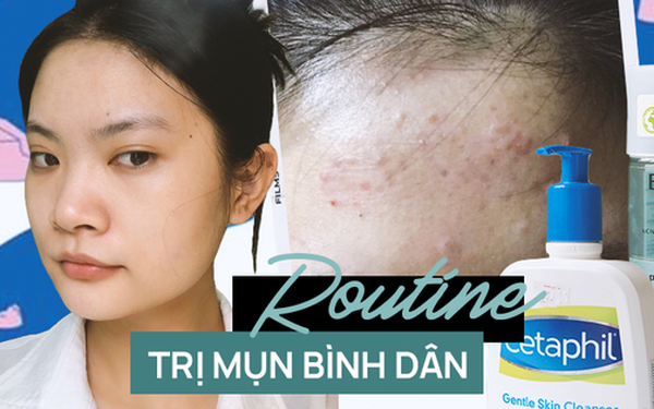 Having persistent acne for 1 year, I found a skin care and acne treatment cycle with popular products from only 92k