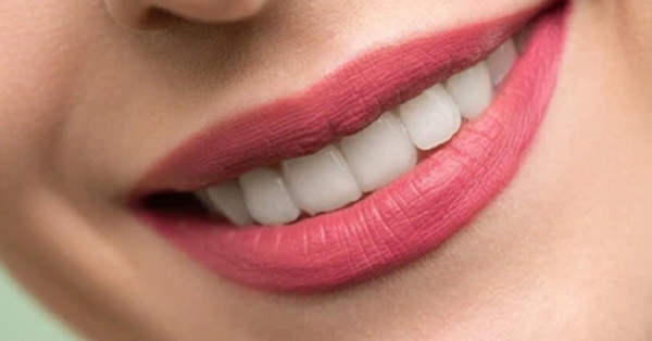 Common Summer Mistakes That Can Damage Your Teeth