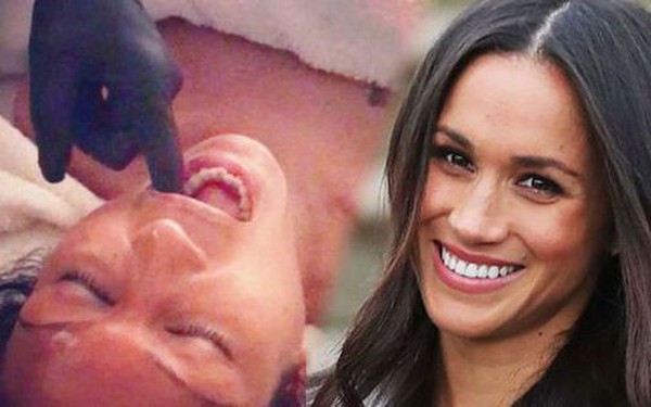 To keep her youth, Meghan Markle performed therapy to make people “round eyes and flat eyes”