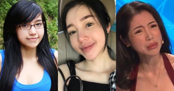 Những điểm biến đổi trên khuôn mặt của Elly Trần sau phẫu thuật thẩm mỹ là gì?
