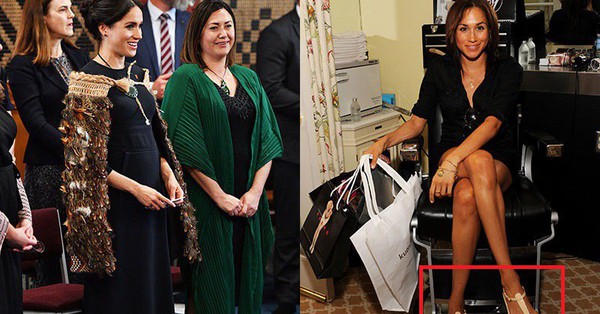 Để có vẻ ngoài hoàn hảo như hiện tại, Meghan Markle từng phẫu thuật 1 vị trí vô cùng đau đớn và nguy hiểm