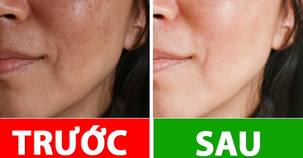 10 bí kíp giúp da bạn luôn rạng rỡ dù đông hay hè, bí quyết thứ 6 sẽ khiến chị em giật mình