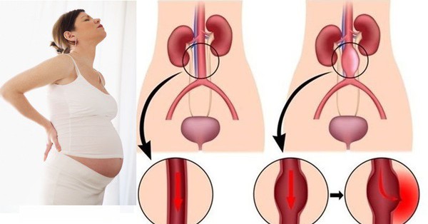 Điều gì xảy ra khi có nhịp đập ở bụng lạ dấu hiệu mang thai ?