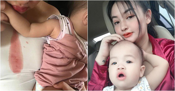 Bố hút thuốc lá xong chơi với con, không ngờ con bị ngộ độc không khí đến mức nôn ra máu