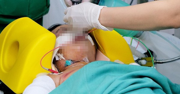 Vụ xe tải cán bố mẹ tử vong, con 5 tuổi nguy kịch: Sức khỏe bé gái hiện thế nào?