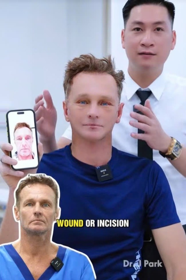 Người đàn ông Úc không chụp ảnh suốt 20 năm bỗng nổi tiếng sau khi đến Việt Nam phẫu thuật thẩm mỹ, điện thoại Iphone cũng không nhận diện được - Ảnh 3.