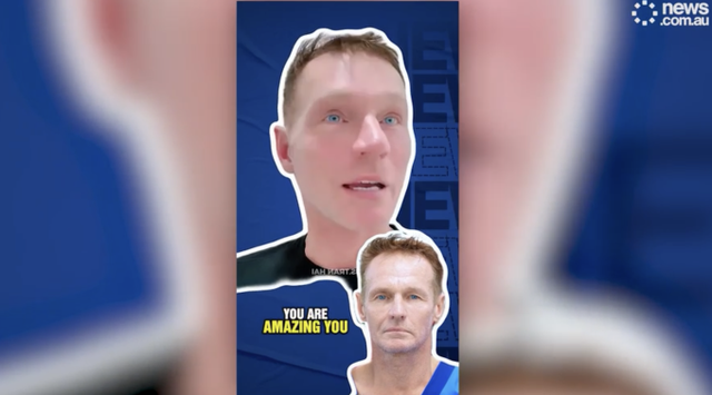 Người đàn ông Úc không chụp ảnh suốt 20 năm bỗng nổi tiếng sau khi đến Việt Nam phẫu thuật thẩm mỹ, điện thoại Iphone cũng không nhận diện được - Ảnh 2.