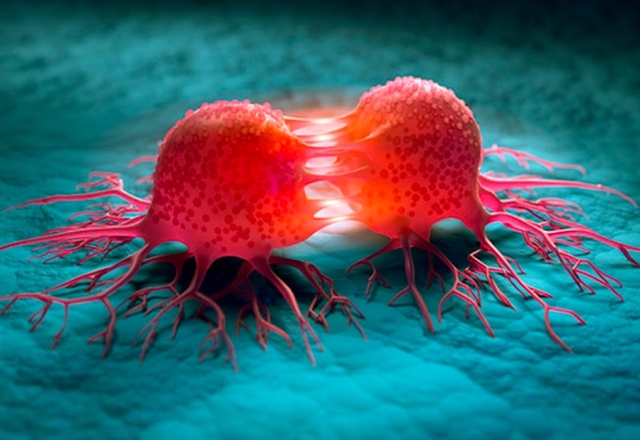 Bác sĩ Mỹ chia sẻ 5 món ăn nhẹ làm tăng khả năng chống ung thư ruột kết gấp bội, ban đầu thấy lạ nhưng “càng ăn càng mê” - Ảnh 1.