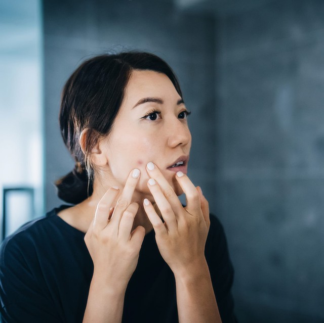 Cứ đổ lỗi cho stress, ai ngờ nguyên nhân mệt mỏi, da xấu, tóc rụng là do thiếu dưỡng chất này: 8 dấu hiệu phụ nữ rất dễ gặp - Ảnh 4.