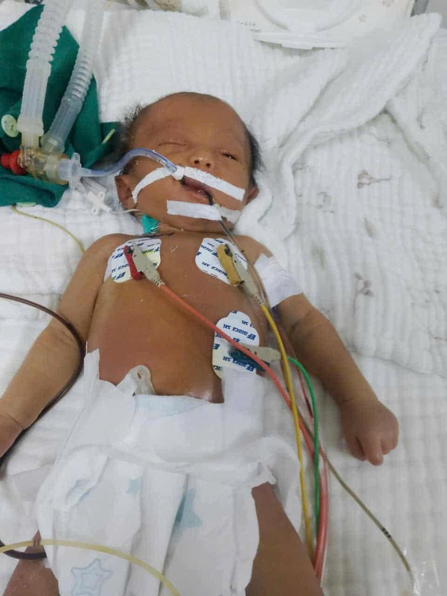 Hoàn cảnh éo le của sản phụ có con sơ sinh nguy kịch vì bệnh hiểm nghèo - Ảnh 1.