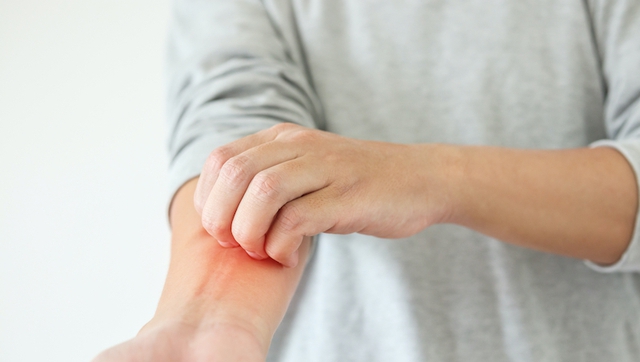 Người đàn ông 40 tuổi phát hiện ung thư gan giai đoạn cuối: Đáng tiếc ông đã bỏ qua dấu hiệu suốt 3 tháng - Ảnh 1.