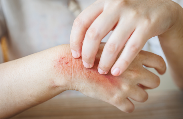 Người đàn ông 40 tuổi phát hiện ung thư gan giai đoạn cuối: Đáng tiếc ông đã bỏ qua dấu hiệu suốt 3 tháng - Ảnh 4.