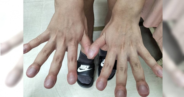 Cơn ho tưởng v&ocirc; hại của cậu b&eacute; 15 tuổi v&agrave; chẩn đo&aacute;n khiến cả gia đ&igrave;nh sụp đổ - Ảnh 2.