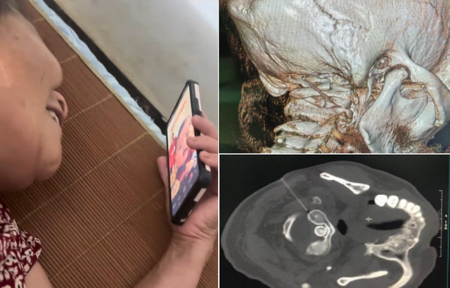 Nghiện xem phim ngắn “trùng sinh, tổng tài”, người phụ nữ 57 tuổi đầu đau “như búa bổ” - Ảnh 2.