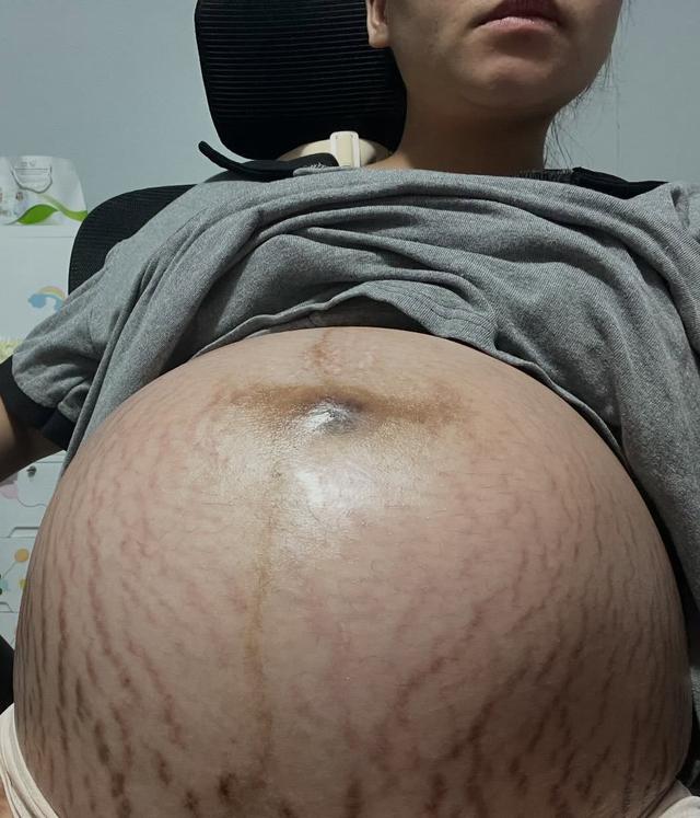  - Ảnh 2.