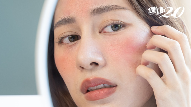 Nữ nghệ sĩ khổ sở v&igrave; bệnh da suốt 7 năm, s&aacute;ng soi gương l&agrave; bật kh&oacute;c: B&aacute;c sĩ cảnh b&aacute;o bệnh trứng c&aacute; đỏ kh&ocirc;ng chỉ li&ecirc;n quan đến da mặt - Ảnh 4.
