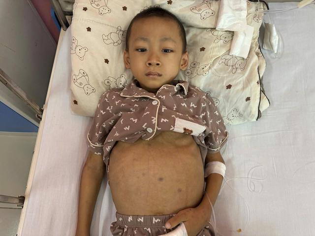 &Aacute;nh mắt cầu cứu của b&eacute; trai 6 tuổi mắc bệnh hiểm ngh&egrave;o, kh&ocirc;ng tiền cứu chữa - Ảnh 1.