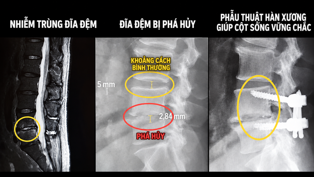  - Ảnh 1.