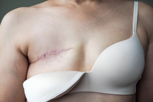Nữ bác sĩ được chẩn đoán mắc 