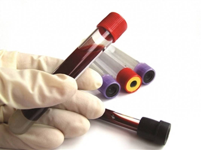 2 Thực phẩm l&agrave;m tăng triglyceride mạnh hơn cả thịt chi&ecirc;n r&aacute;n m&agrave; bạn kh&ocirc;ng ngờ tới - Ảnh 4.