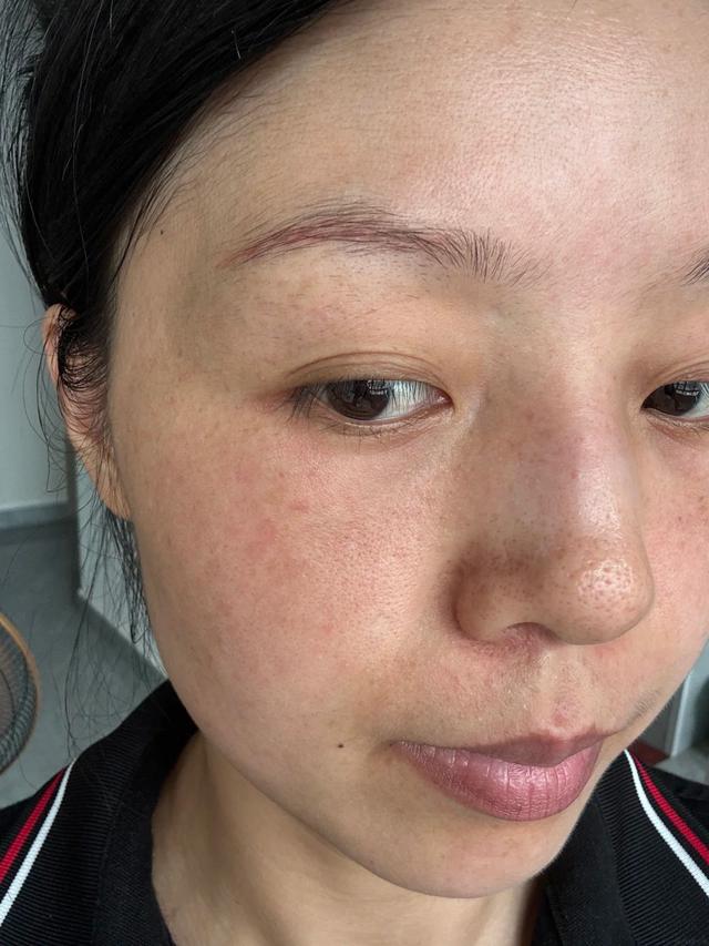 Da đẹp kh&ocirc;ng đến từ việc b&ocirc;i serum hay đắp mặt nạ: 7 nguy&ecirc;n tắc t&ocirc;i theo đuổi suốt 2 năm - Ảnh 2.