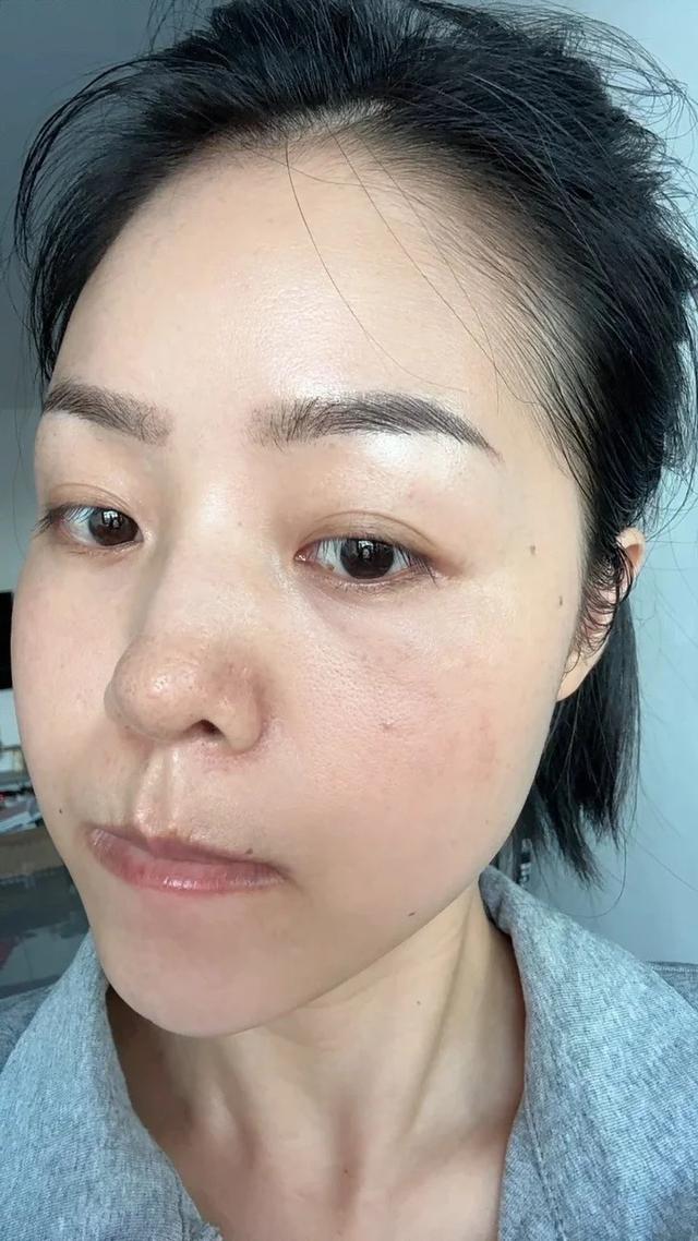 Da đẹp kh&ocirc;ng đến từ việc b&ocirc;i serum hay đắp mặt nạ: 7 nguy&ecirc;n tắc t&ocirc;i theo đuổi suốt 2 năm - Ảnh 8.