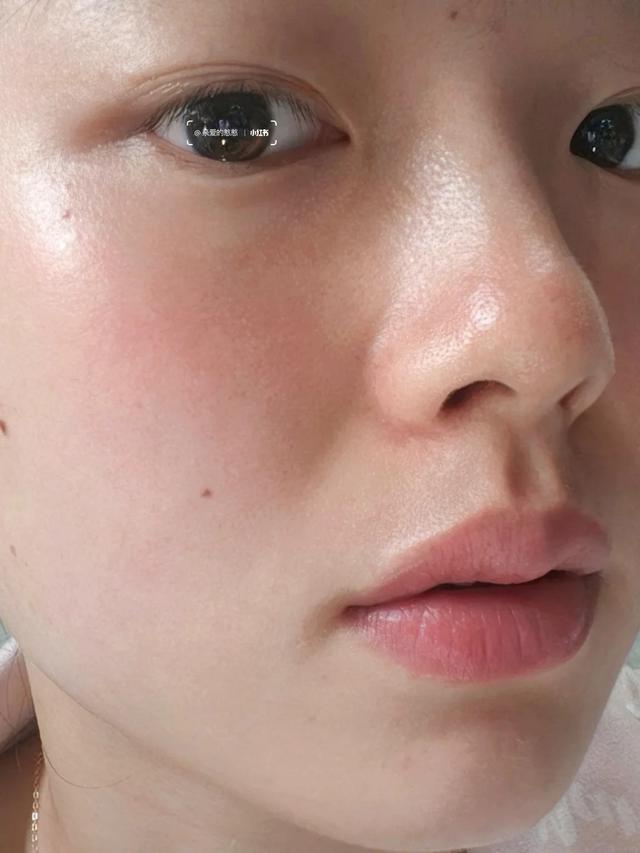 Da đẹp kh&ocirc;ng đến từ việc b&ocirc;i serum hay đắp mặt nạ: 7 nguy&ecirc;n tắc t&ocirc;i theo đuổi suốt 2 năm - Ảnh 10.